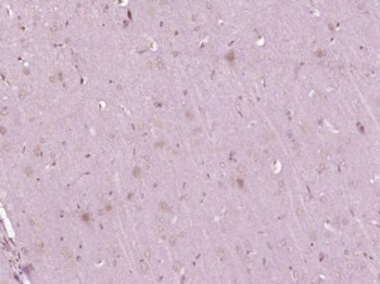 FRMD4A Polyclonal Antibody
