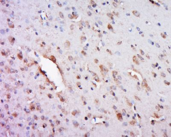 FAM113A Polyclonal Antibody