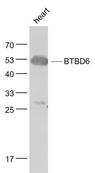 BTBD6 Polyclonal Antibody