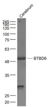 BTBD6 Polyclonal Antibody
