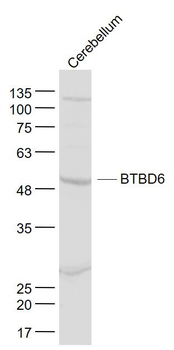 BTBD6 Polyclonal Antibody