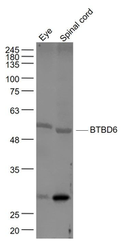 BTBD6 Polyclonal Antibody