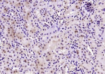 BRD7 Polyclonal Antibody