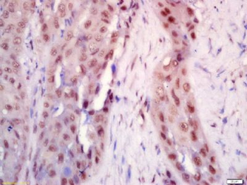 BRD7 Polyclonal Antibody