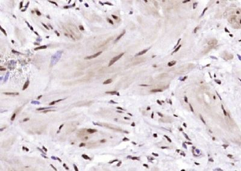 BRD7 Polyclonal Antibody