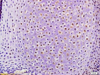 AMSH Polyclonal Antibody