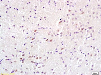BS69 Polyclonal Antibody