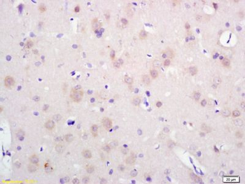 SEC14 like protein 2 Polyclonal Antibody