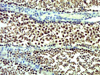 DOCK1 Polyclonal Antibody