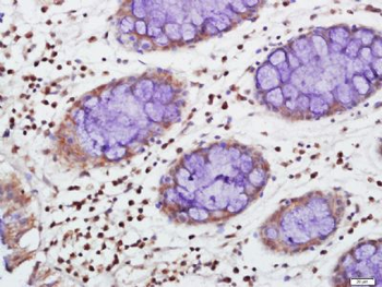 TIA1 Polyclonal Antibody
