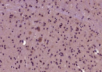 CDC2L6 Polyclonal Antibody
