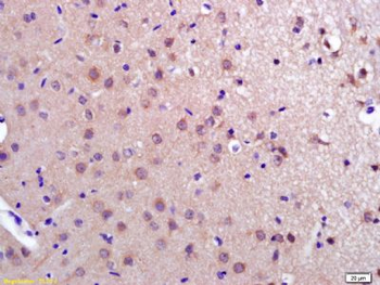 PDCD10 Polyclonal Antibody