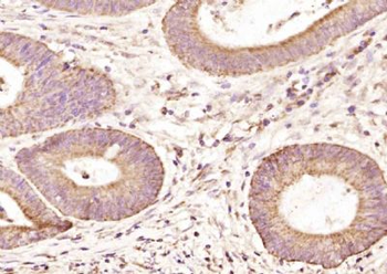 PTPMT1 Polyclonal Antibody