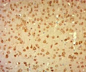 Laminin alpha 1 Polyclonal Antibody