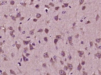 SDF2L1 Polyclonal Antibody