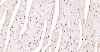 GRIM19 Polyclonal Antibody