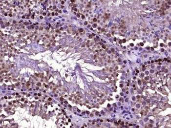 RAD51C/TDRD1 Polyclonal Antibody