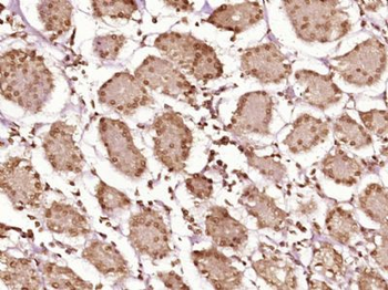 RBM15B Polyclonal Antibody