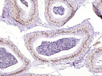 RAD51AP2 Polyclonal Antibody