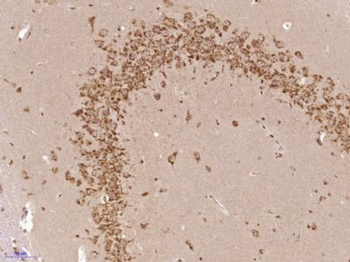 PAPD4 Polyclonal Antibody