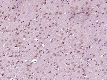 POU4F3 Polyclonal Antibody