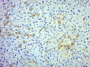 SERPIN A11 Polyclonal Antibody