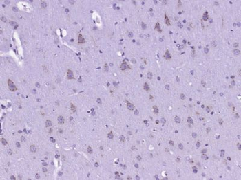 CARD12 Polyclonal Antibody