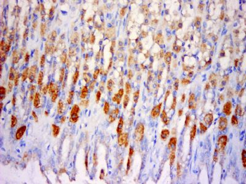 SLC25A38 Polyclonal Antibody