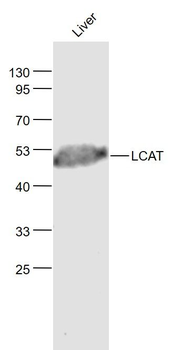 LCAT Polyclonal Antibody