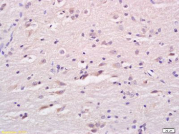 LCAT Polyclonal Antibody