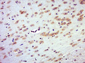 RAB3IL1 Polyclonal Antibody
