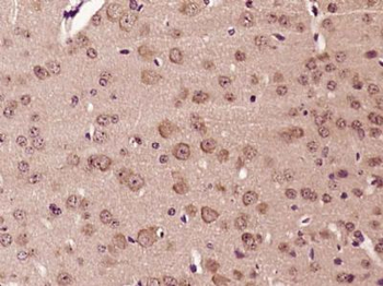 LMBRD1 Polyclonal Antibody