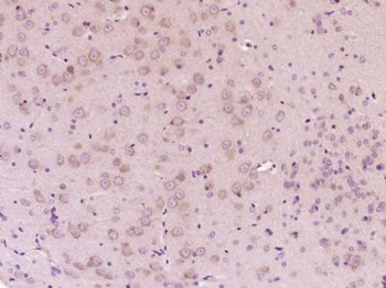 MTO1 Polyclonal Antibody