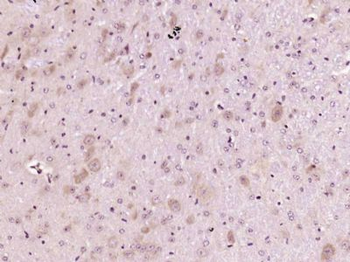 MTO1 Polyclonal Antibody