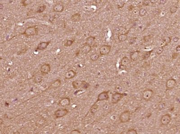 SIPA1L1 Polyclonal Antibody