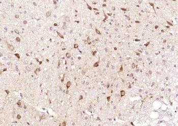 SAFB Polyclonal Antibody