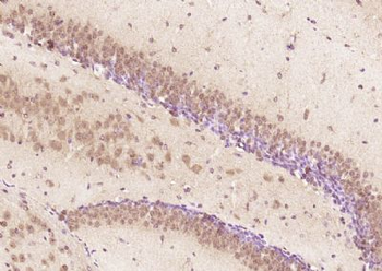 SAFB Polyclonal Antibody