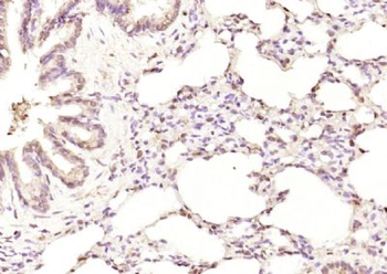 Karyopherin beta 3 Polyclonal Antibody