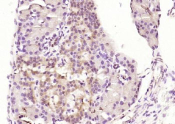 Karyopherin beta 3 Polyclonal Antibody