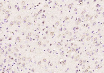 Kindlin Polyclonal Antibody