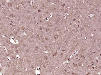 KIF13A Polyclonal Antibody