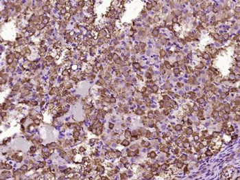 KIF13A Polyclonal Antibody