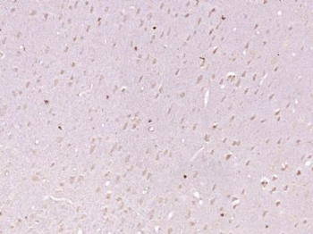KIAA1755 Polyclonal Antibody