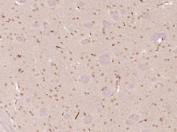 KIAA1755 Polyclonal Antibody