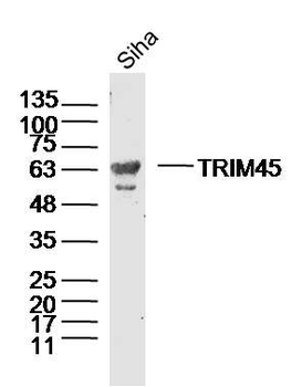 TRIM45 Polyclonal Antibody