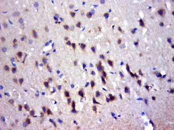 TRIM45 Polyclonal Antibody
