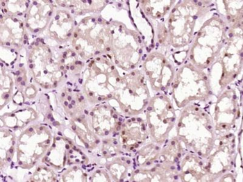 ZNF687 Polyclonal Antibody