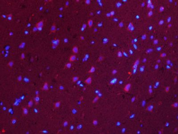RUFY4/FLJ46536 Polyclonal Antibody