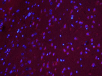 RUFY4/FLJ46536 Polyclonal Antibody