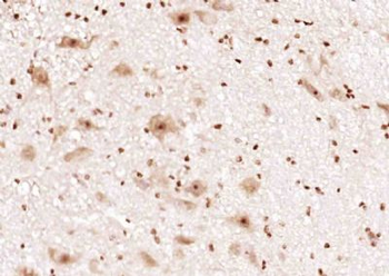 RGS14 Polyclonal Antibody